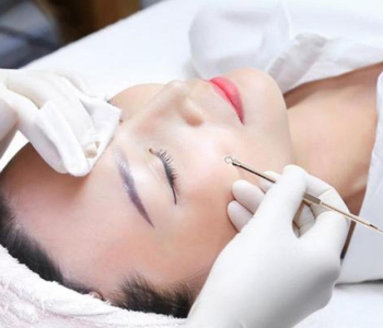 CHĂM SÓC DA MỤN 